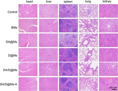 Tumor Cell-Specific and Lipase-Responsive Delivery of Hydrogen Sulfide for Sensitizing Chemotherapy of Pancreatic Cancer